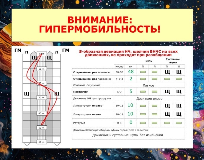 Внимание: гипермобильность!